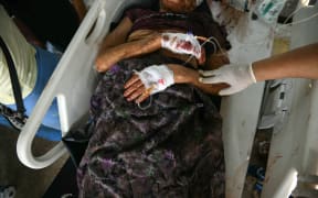 An earthquake survivor is transported in the compound of a hospital in Naypyidaw on March 28, 2025, after an earthquake in central Myanmar. A powerful earthquake rocked central Myanmar on March 28, buckling roads in capital Naypyidaw, damaging buildings and forcing people to flee into the streets in neighbouring Thailand. (Photo by Sai Aung MAIN / AFP)