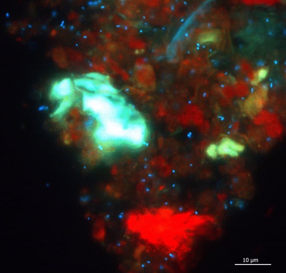 The blue dots in this image of cow rumen contents represent methanogens.