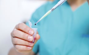lab technician using pipette