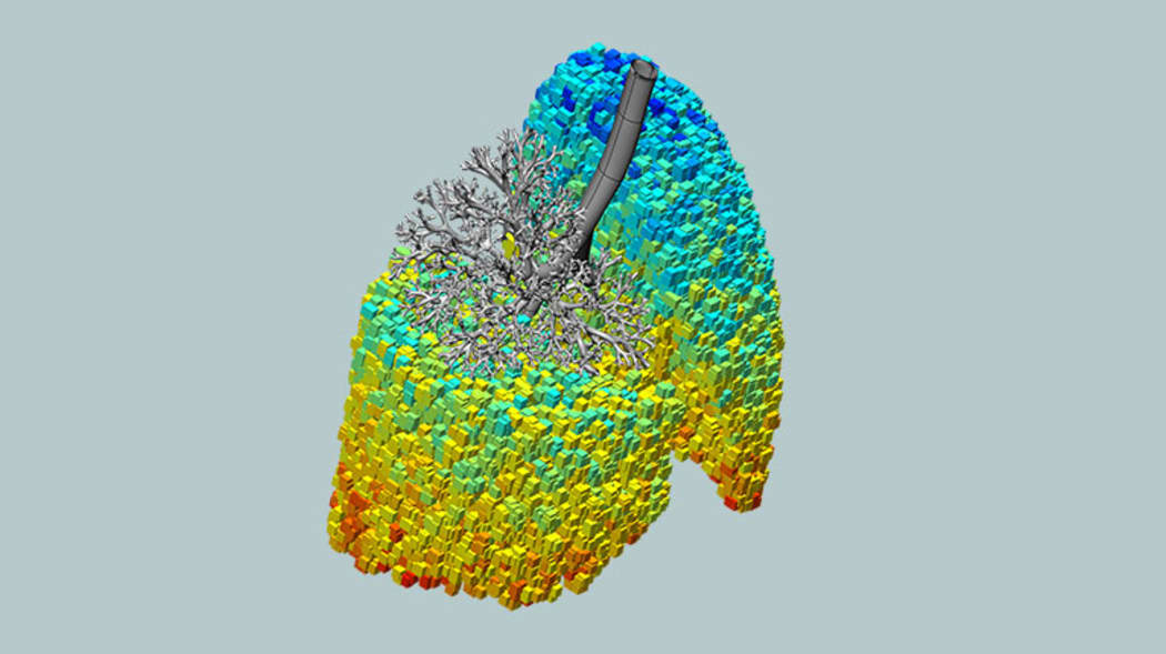 Imaged lung with building blocks