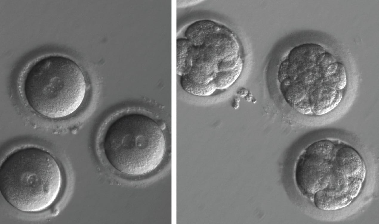 Newly fertilised eggs before gene editing, left, and embryos after gene editing and a few rounds of cell division.