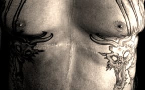 Skuldom's Faeces Christ and his onstage injuries.