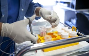 Samples of a colon biopsy to be sent to a laboratory, at Diaconesses Croix Saint-Simon Hospital, Paris, France (2009).