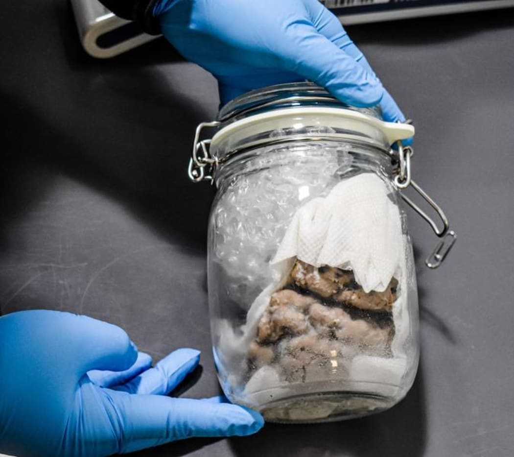 US Customs and Border Protection seized the brain in a jar at the US-Canada border.
