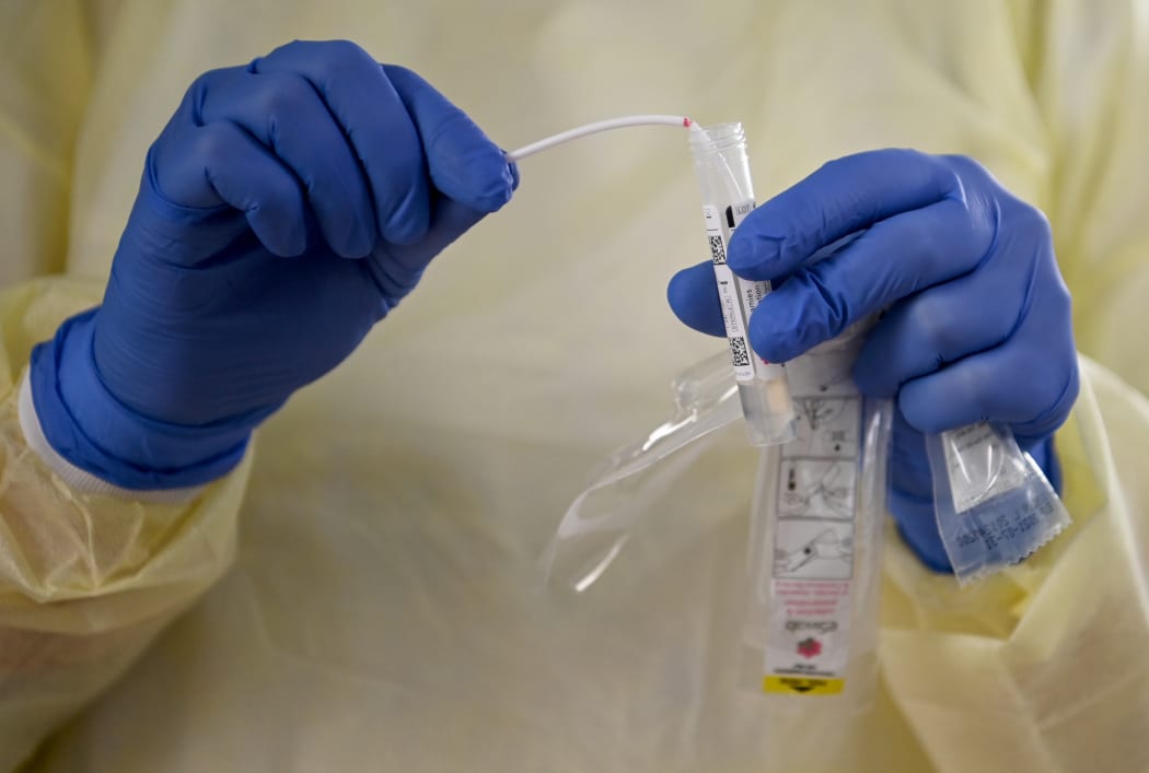 16 November 2020, Berlin:A study assistant, holds a tube with the swab for a PCR test for an antibody study of Robert Koch Institute