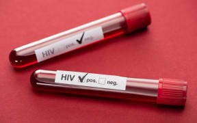 selective focus of negative and positive hiv blood sample test on red background