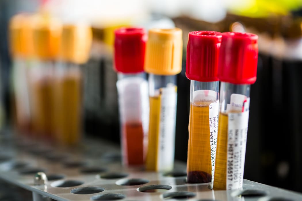 Blood samples with Hepatitis B and C viruses in a hospital in France