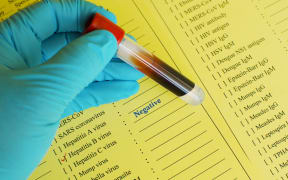 The Hepatitis Foundation and a trust linked to it are being investigated by Charities Services.