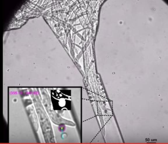 frame grab of fungal hyphae