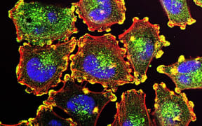 Molecular basis for melanoma cell motility