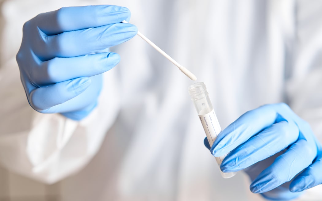 Doctor holding swab test tube for 2019-nCoV analyzing. Coronavirus test. Blue medical gloves and protective face mask for protection against covid-19 virus. Coronavirus and pandemic