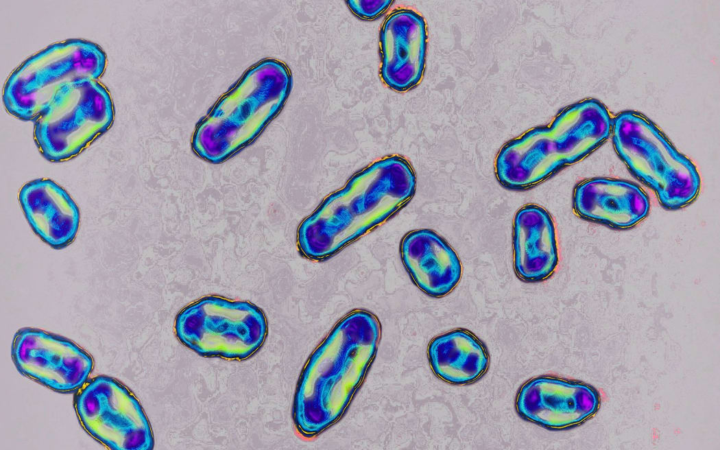 Plague is caused by the bacteria Yersinia pestis and is spread to humans through infected flea bites or contact with infected animals.