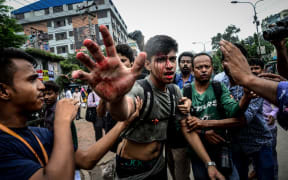 A photographer is targetted during a student protest in Dhaka.