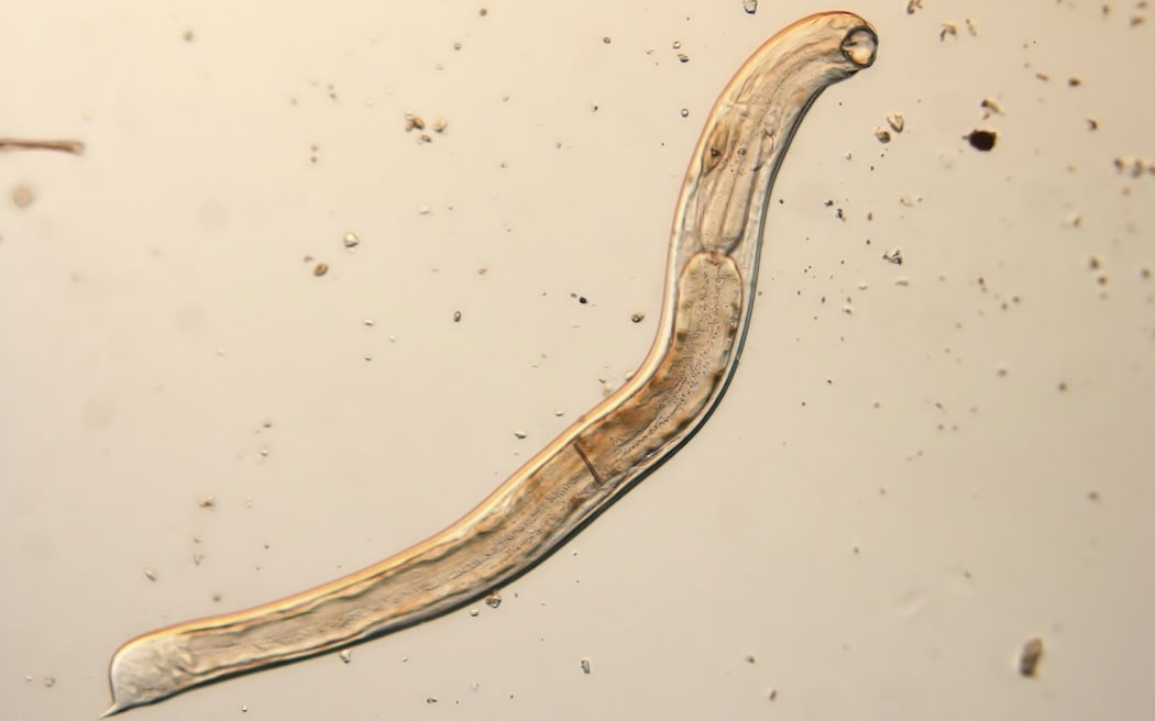 Image of a hookworm