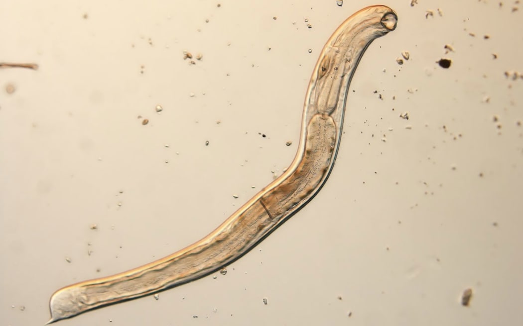 Infection with benefits: How playing host to hookworms could be good for  you