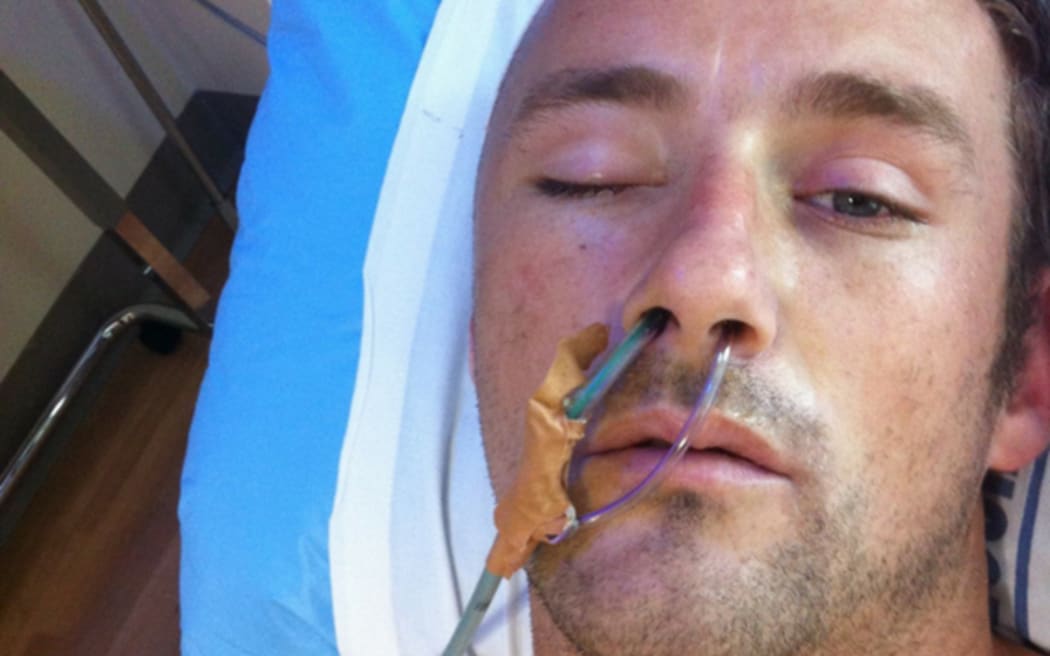 Benjamin Lightbody in hospital after the attack in Mt Eden prison in 2013.
