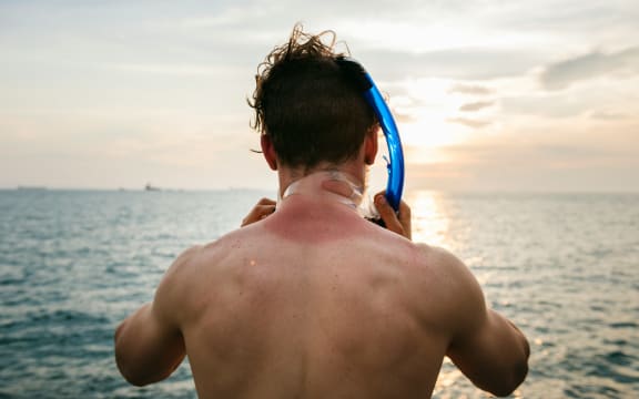 Man with sunburnt neck in the sea prepares to snorkel.