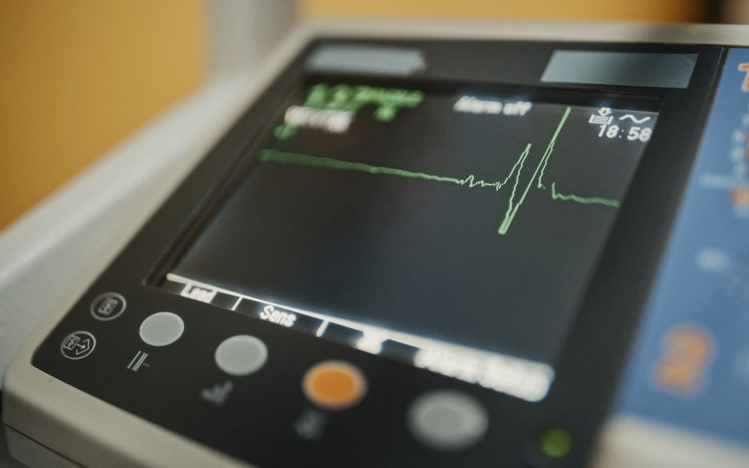 Vital signs monitor showing heart rate. (Photo by GORODENKOFF PRODUCTIONS/SCIENCE / GPR / Science Photo Library via AFP)
