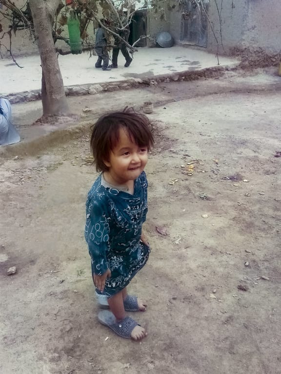 The book's authors provided this photo, which they say shows the three-year-old, Fatima, who was killed by shrapnel while being held in her mother's arms.
