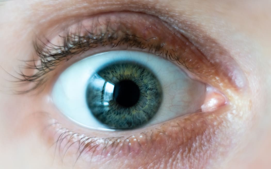 Close-up on male green wide open eye.
