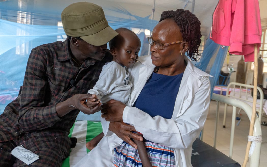 In a clinic in South Sudan, Father Angelo holds the hand of 2-year-old Wilson who is very skinny and has a feeding tube in his nose. Nurse Betty is holding Wilson.