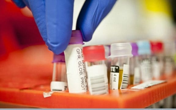 blood testing vacuettes