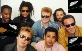 UB40 v Lazer kiwi