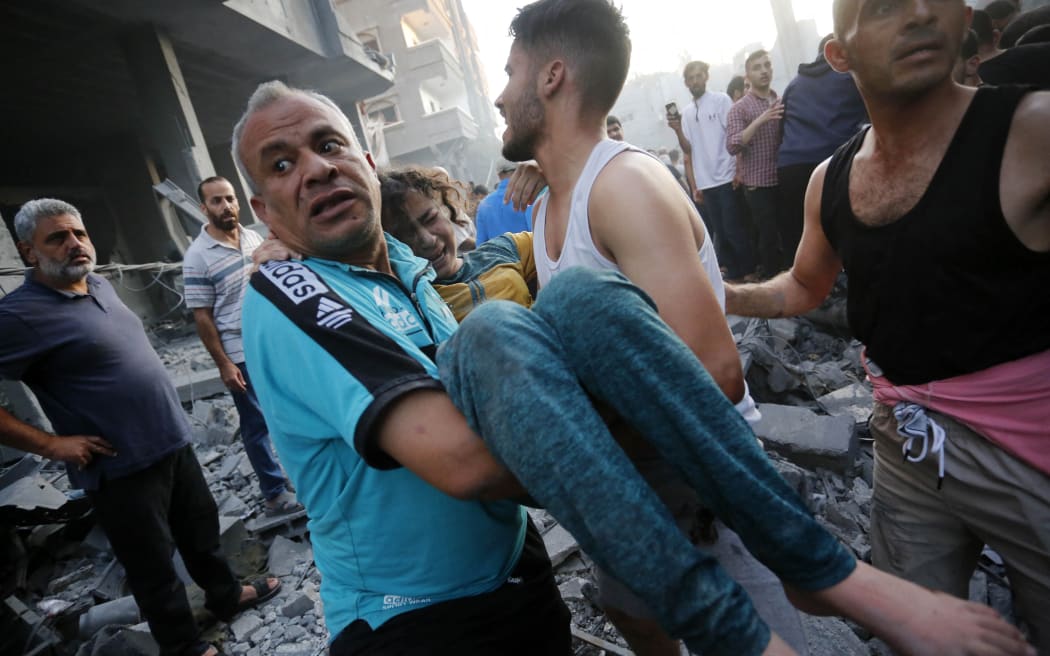 EDITORS NOTE: Graphic content / Men carry away an injured girl following an Israeli strike on the town of Deir Al-Balah in the central Gaza Strip on October 18 2023. Thousands of people, both Israeli and Palestinians have died since October 7, 2023, after Palestinian Hamas militants based in the Gaza Strip, entered southern Israel in a surprise attack leading Israel to declare war on Hamas in Gaza on October 8. (Photo by Mohammed Faiq / AFP)