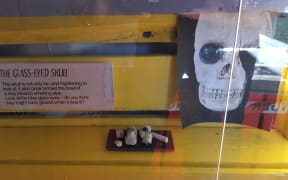 A clay pipe shaped as a skull found in central Christchurch.