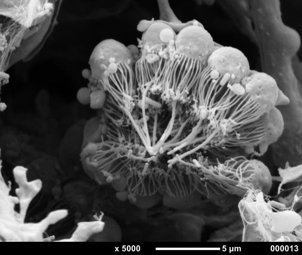 Choanocyte Chamber