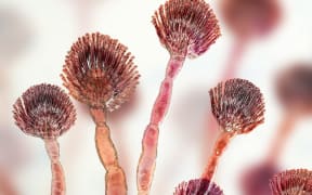Aflatoxin B1, molecular model of mycotoxin and close-up view of Aspergillus flavus fungus. (Photo by KATERYNA KON/SCIENCE PHOTO LIBRA / KKO / Science Photo Library via AFP)