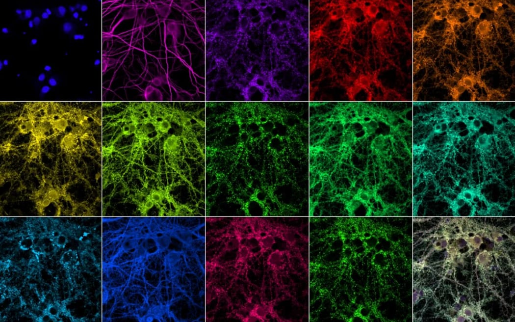 Computer imaging of neuronal synapses in the brain. Conventional images of cell nuclei and two proteins (top row, three images on the left), along with 11 PRISM images of proteins and one composite, multiplexed image (bottom row, right).