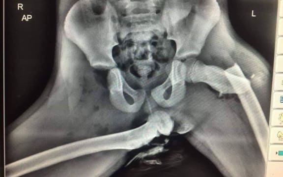 Photo tweeted by Welsh Sergeant Ian Price of horrific injuries sustained to the front seat passenger who had their feet on the dashboard.