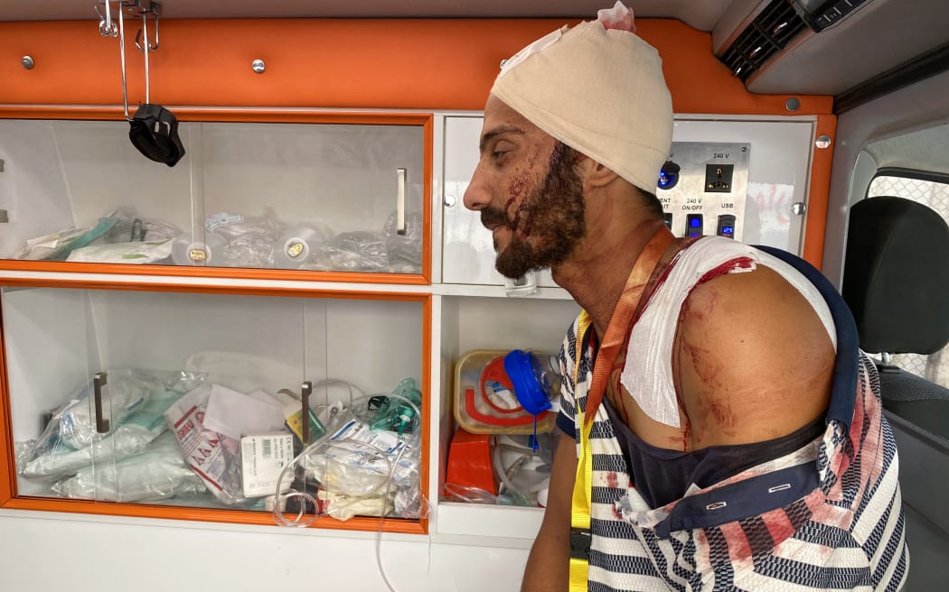 A Palestinian man who was injured in Israeli fire at a gathering spot near a US-backed aid center in the Rafah area sits in an ambulance after receiving first aid.