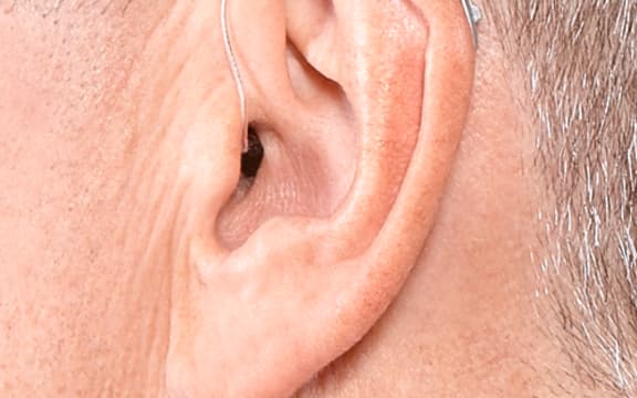 Made for iPhone Receiver-in-Canal Hearing Aid.