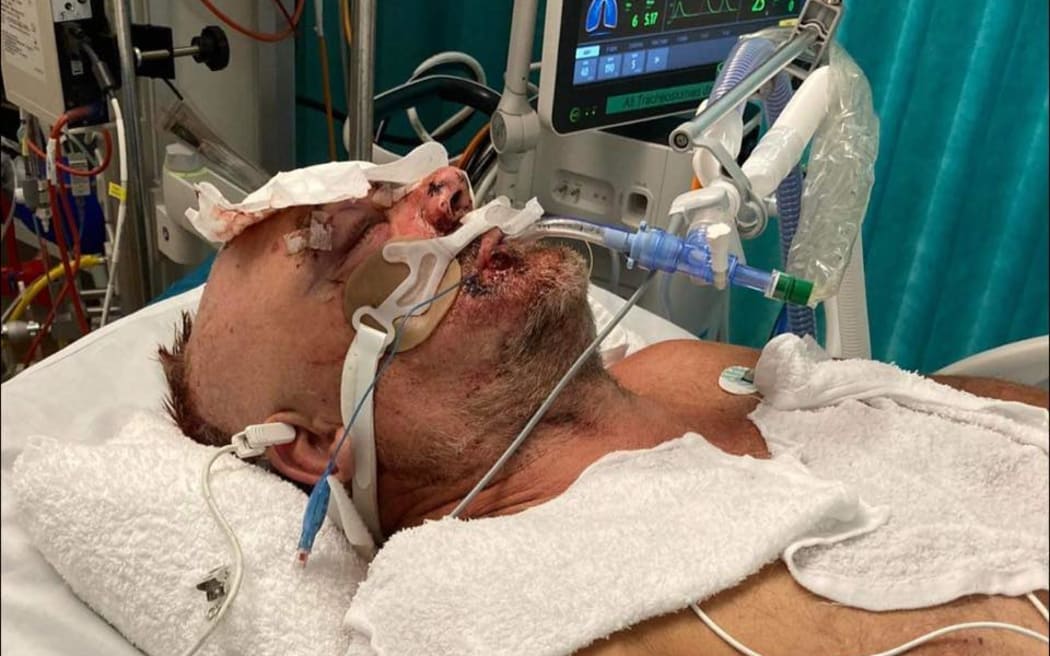 Trevor Moore was taken by helicopter to Wellington Hospital after he was severely injured on 31 May.