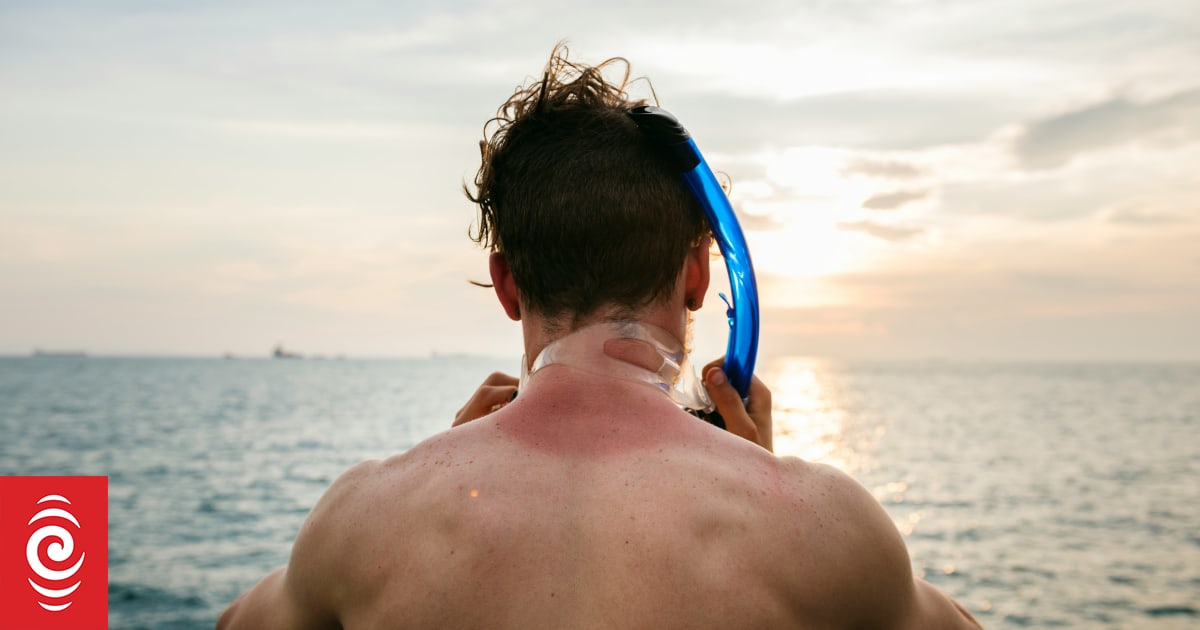 I accidentally got sunburnt - what should I do?