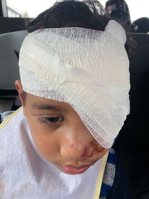 Masua Tusa's mum Mully says her son's injuries looked more like burns.
