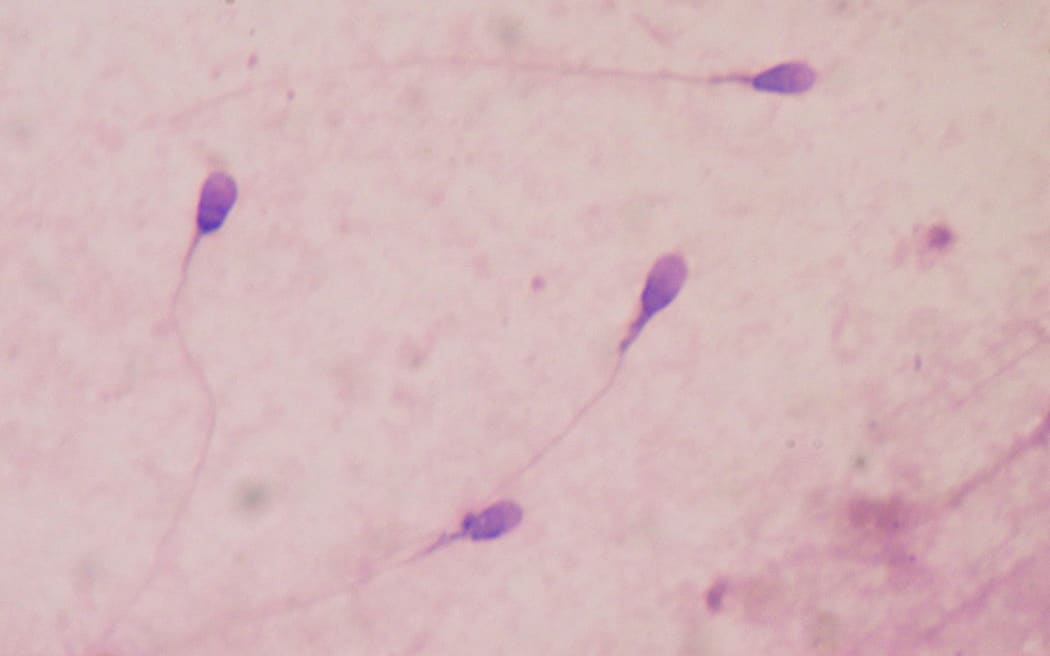 Sperm health - cocktail of chemicals causing alarming decline | RNZ