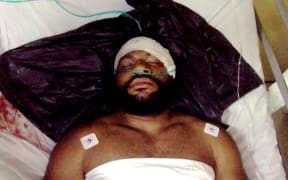 Stephen Lichas was chased and shot by Papua New Guinea police when he fled the University of PNG's Waigani Campus after they opened fire on hundreds of students