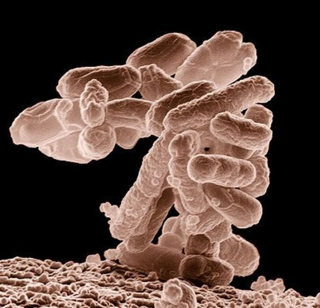 Low-temperature electron micrograph of a cluster of E. coli bacteria, magnified 10,000 times. Each individual bacterium is oblong shaped.(
