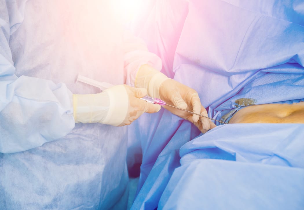 Arthroscope surgery. Orthopedic surgeons in teamwork in the operating room with modern arthroscopic tools. Hospital background