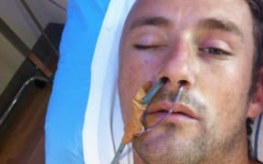 Benjamin Lightbody in hospital after the attack in Mt Eden prison in 2013.