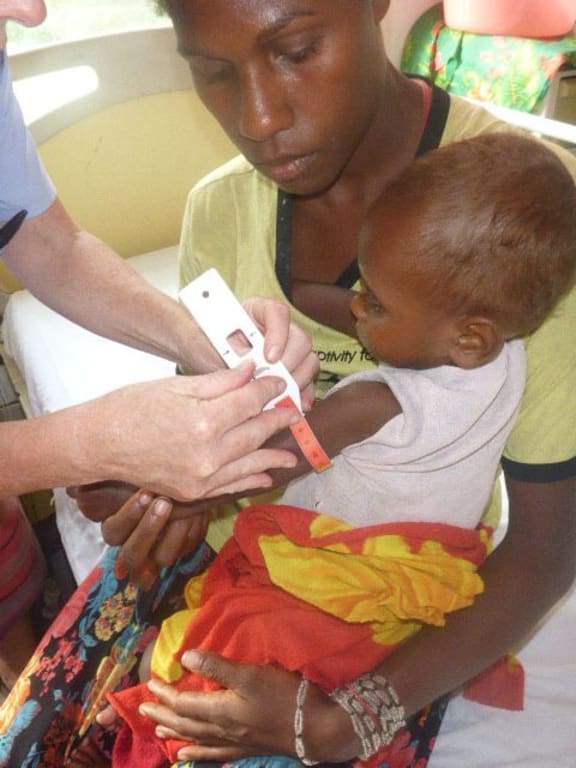 A baby goes through a common manutrition screening at Lenakel Hospital.