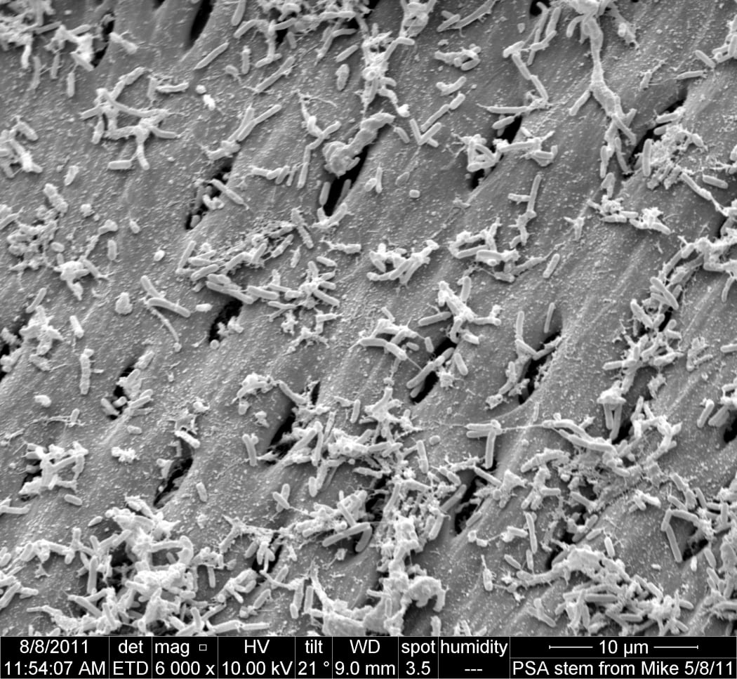 Hundreds of kwifruit Psa bacteria infecting the stem of a kiwifruit vine.
