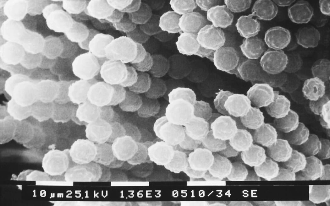 Aspergillus is a fungus that is very common in the environment, found in soil, on plants and in decaying plant matter.
Mandatory Credit:	Smith Collection/Gado/Archive Photos/Getty Images via CNN Newsource