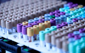 blood tests