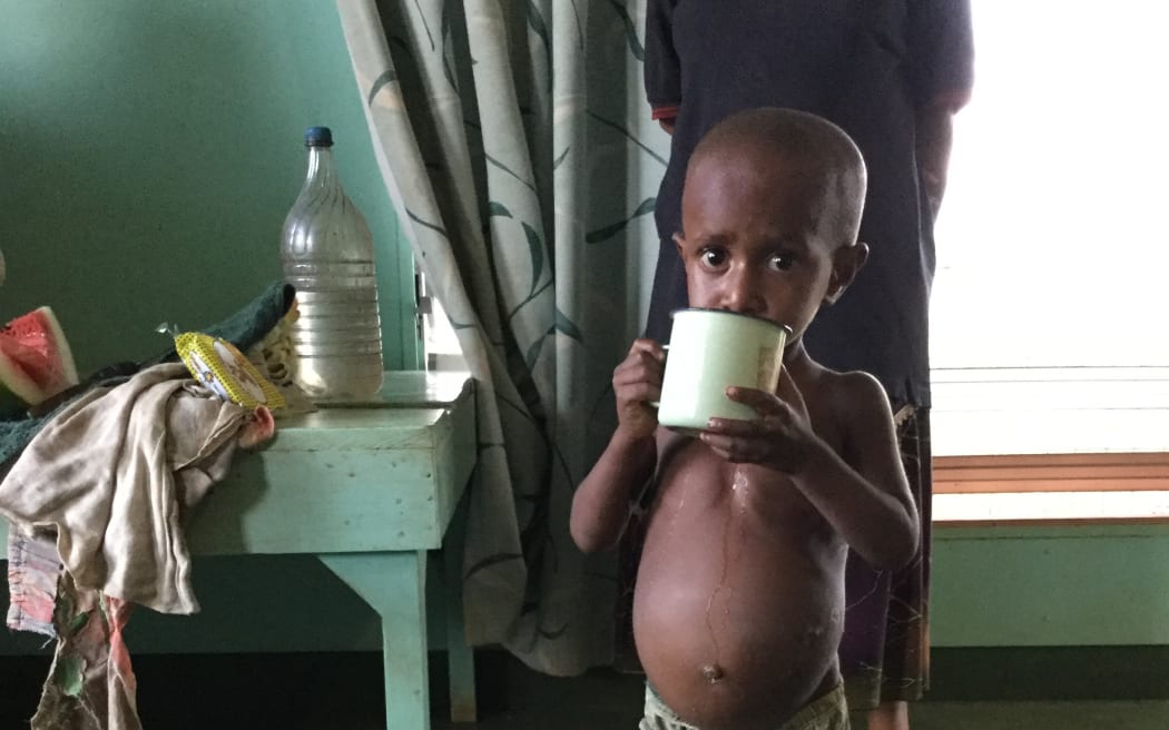 A malnourished child in PNG has a drink of water. His equally malnourished pregnant mother walked two days to reach the clinic going into labour along the way and giving birth to twin girls one of whom did not survive.