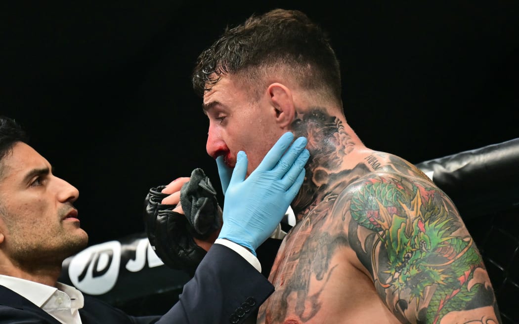 Britain’s Tom Aspinall gets checked after being hit in the eye while fighting  France’s Ciryl Gane during their UFC heavyweight title bout at UFC 321 at Etihad Arena in Abu Dhabi early on October 26, 2025. (Photo by Giuseppe CACACE / AFP)
