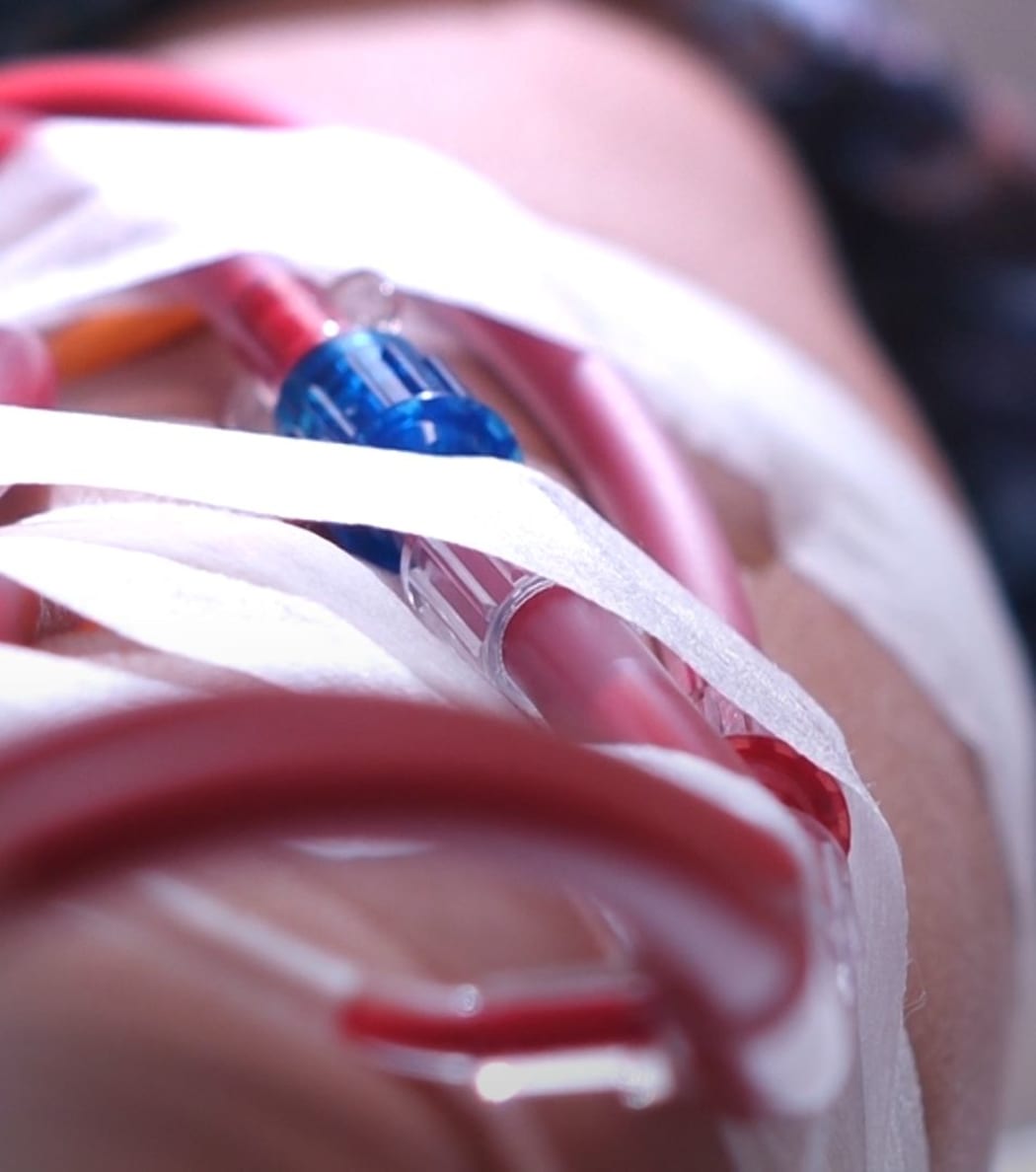 A maze of tubes carries blood to the dialysis machine.